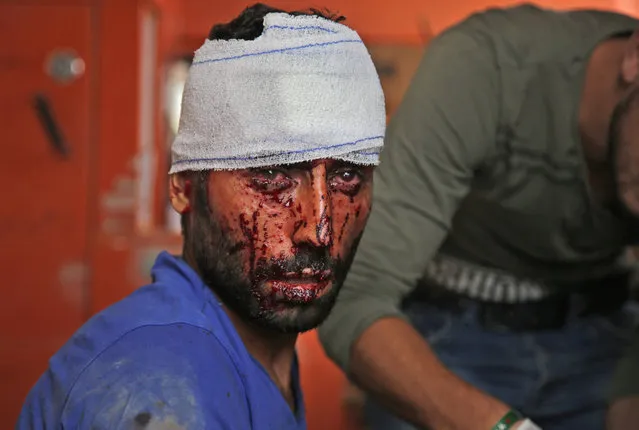 A Syrian man receives treatment on October 20, 2019, in the Syrian border town of Tal Abyad which was seized by Turkey-backed forces last week. (Photo by Bakr Alkasem/AFP Photo)