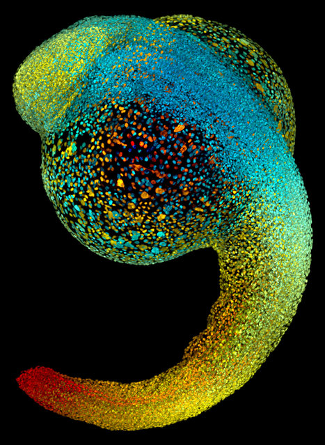 Live zebrafish embryo at 22 hours post-fertilization; SiMView Light-Sheet Microscopy, 0X. Howard Hughes Medical Institute (HHMI), Ashburn, Virginia, USA. (Photo by Dr. Philipp Keller/Nikon Small World 2014)