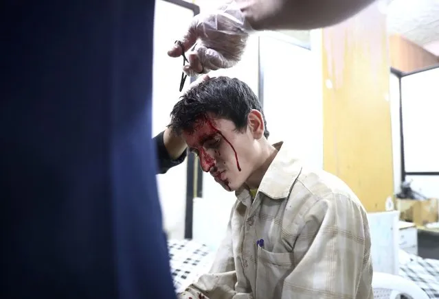 A wounded Syrian man receives treatment at a make-shift hospital following reported government shelling on the rebel-held town of Douma, east of the Syrian capital Damascus, on October 26, 2016. (Photo by Abd Douman/AFP Photo)