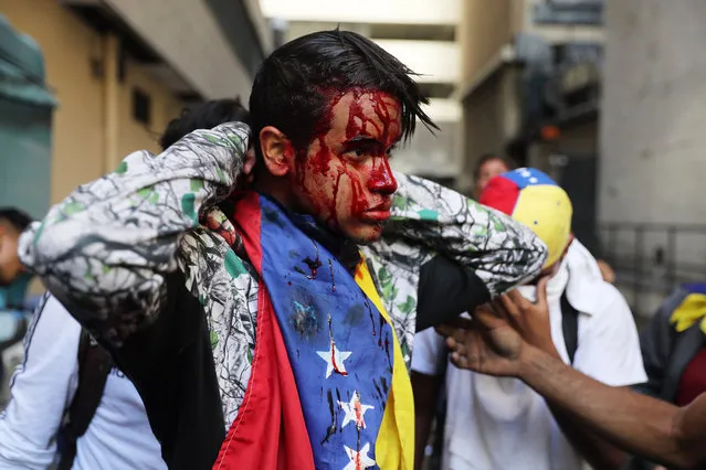 A wounded protester as thousands take to the streets during a protest against President Maduro in Caracas, Venezuela, 23 January 2019 (reissued 24 January 2019). Venezuela has fallen into a new deep political crisis after National Assembly leader Juan Guaido declared himself interim president of Venezuela 23 January and promised to guide the country toward new election as he consider last May's election not valid. Many Heads of State and governments have recognized Guaido as president, among them US President Donald Trump, Canadian Government and Brazil President Jair Bolsonaro. Nicolas Maduro became president in 2013 after the death of Hugo Chavez and was sworn in for a second term on May 2018. Venezuela has been facing an economic and social crisis where the inflation, according to the document of the National Assembly, has reached 80.000 per cent per cent in 12 months and the shortages of basic items have lead millions of people into poverty while according to reports up to three million Venezuelans have left the country since 2014. (Photo by Miguel Gutiérrez/EPA/EFE)