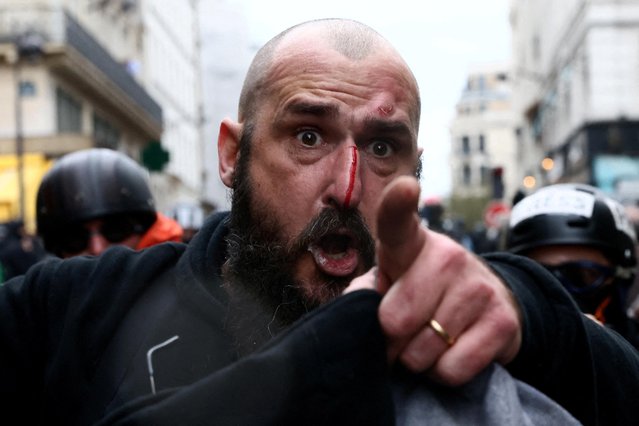 An injured man reacts during a demonstration as part of the ninth day of nationwide strikes and protests against French government's pension reform, in Paris, France on March 23, 2023. (Photo by Yves Herman/Reuters)