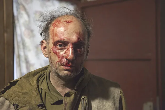In this handout photo released by Greenpeace, Michael Kreindlin, a Greenpeace Russia staff member, poses for a photo after being beaten by attackers in Mogukorovka village, the Kuban region, 1120 kilometers (700 miles) south from Moscow, Russia, Friday, September 9, 2016. Masked men armed with guns, knives and stun grenades have attacked a camp of volunteer firefighters who came to southern Russia to help to put out forest fires. (Photo by Maria Vasileva/Greenpeace Photo via AP Photo)