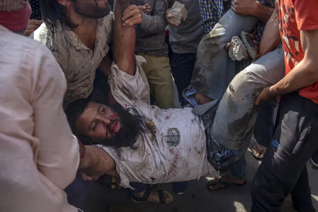 Kashmiri protesters tend to an injured man after a paramilitary vehicle ran over him during a protest in Srinagar, Indian controlled Kashmir, Friday, June 1, 2018. (Photo by Dar Yasin/AP Photo)