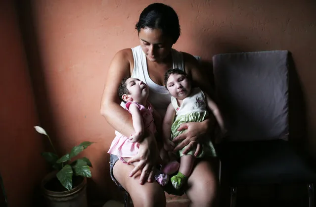 Mother Raquel holds her twin daughters Eloa (L) and Eloisa, 8 months old and both born with microcephaly, while posing on December 16, 2016 in Areia, Pernambuco state, Brazil. Mother Raquel said she contracted Zika during her pregnancy. As many of the babies born with microcephaly, believed to be linked to the Zika virus, approach or have turned one year old in the region, doctors and mothers are adapting and learning treatments to assist and calm the children. Many suffer a plethora of difficulties including vision and hearing problems with doctors now labeling the overall condition as “congenital Zika syndrome”. Authorities have recorded thousands of cases in Brazil in which the mosquito-borne Zika virus may have led to microcephaly in infants. Microcephaly results in an abnormally small head in newborns and is associated with various disorders. The state with the most cases is Pernambuco. (Photo by Mario Tama/Getty Images)