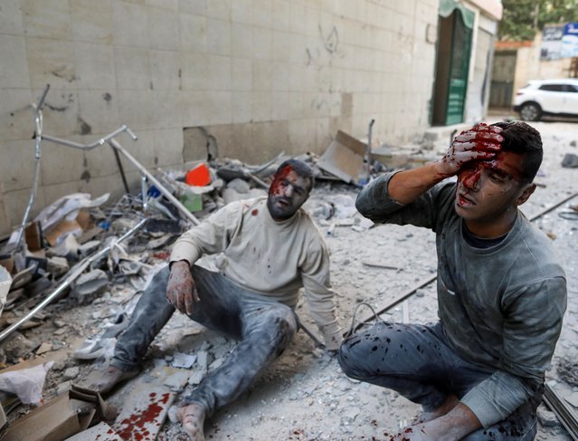 Wounded Palestinians react at the site of an Israeli strike in Khan Younis in the southern Gaza Strip on October 19, 2023. (Photo by Yasser Qudih/Reuters)
