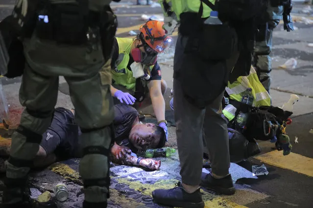 Medical volunteers help an injured man after being attacked by pro-democracy protesters during a crash between protesters and police in Hong Kong, Monday, November 11, 2019. Hong Kong's leader Carrie Lam has pledged to “spare no effort” in bringing an end to anti-government protests that have wracked the city for more than five months, following a day of violence in which one person was shot and another set on fire. (Photo by Kin Cheung/AP Photo)