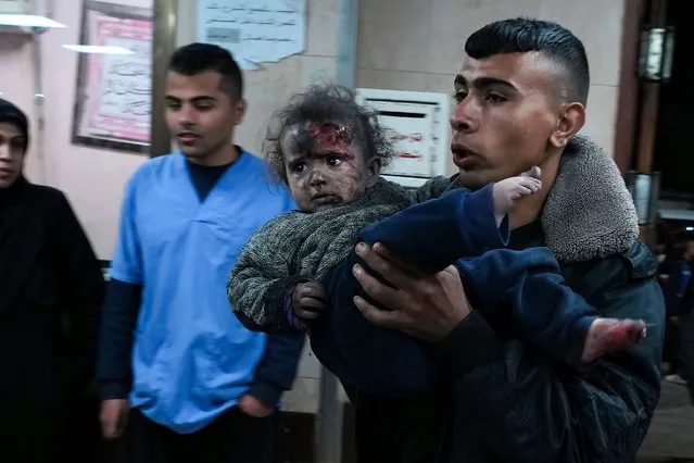 Palestinians wounded in the Israeli bombardment of the Gaza Strip are brought to Al Aqsa hospital in Deir al Balah, Gaza Strip, Thursday, February 22, 2024. (Photo by Adel Hana/AP Photo)