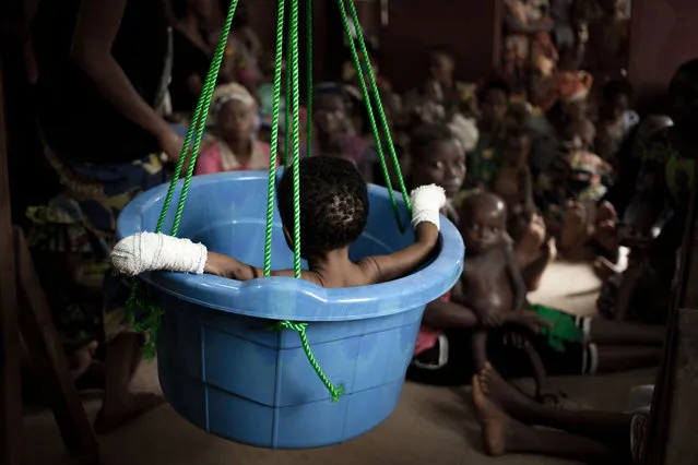 A malnourished child is weighed while other children wait their turn in the Bangui paediatric complex on December 4, 2018. In Central African Republic, infant mortality is the highest in the world, with two out of three children, or 1.5 million people, in need of humanitarian assistance, according to a UNICEF report from 2018. (Photo by Florent Vergnes/AFP Photo)