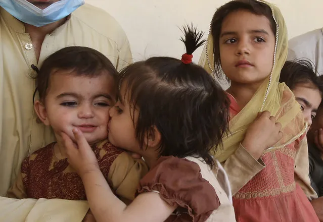 In this May 6, 2020 photo, Tariq Nawaz holds his 10-month-old baby daughter Tuba who suffers from polio, as a sister kisses her, in Suleiman Khel, Pakistan. For millions of people like Nawaz who live in poor and troubled regions of the world, the novel coronavirus is only the latest epidemic. They already face a plethora of fatal and crippling infectious diseases: polio, Ebola, cholera, dengue, tuberculosis and malaria, to name a few. The diseases are made worse by chronic poverty that leads to malnutrition and violence that disrupts vaccination campaigns. (Photo by Muhammad Sajjad/AP Photo)