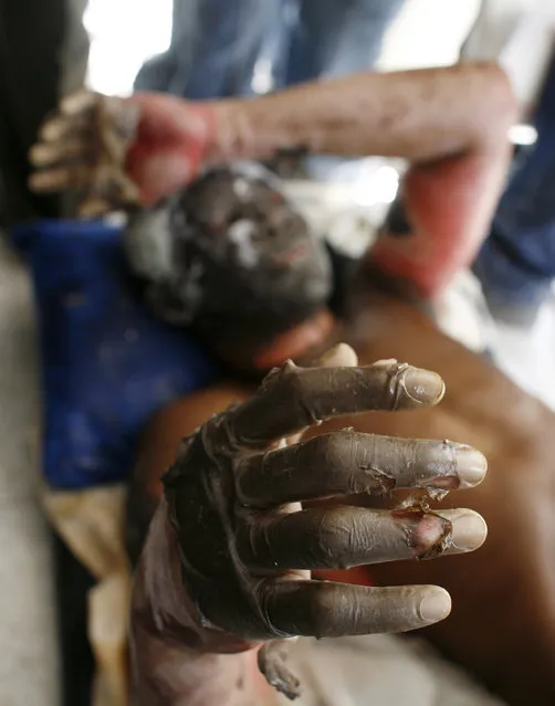 An injured resident reacts after an earthquake in Port-au-Prince, Haiti, January 13, 2010. (Photo by Eduardo Munoz/Reuters)