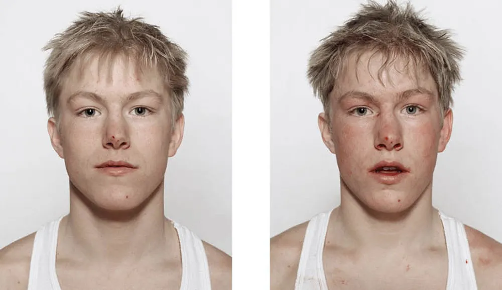 Portraits of Boxers, Before and After by Nicolai Howalt