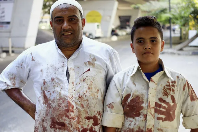 In this Saturday, October 4, 2014 photo, Egyptian butcher Mohammed, left, and his son Ahmed pose for a photo as they work at a slaughterhouse on the first day of the Muslim holiday of Eid al-Adha, or Feast of Sacrifice, in Cairo. (Photo by Hassan Ammar/AP Photo)
