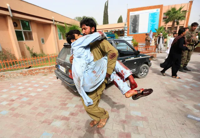 An injured man is carried to a hospital after a car bomb in Jalalabad city, Afghanistan June 17, 2018. (Photo by Reuters/Parwiz)