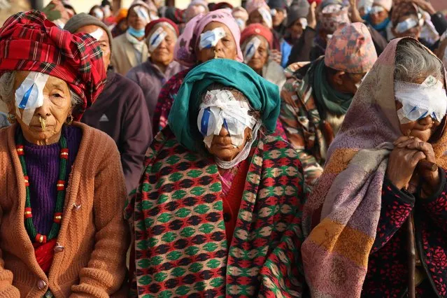 In this photograph taken on March 3, 2023, patients wait for their eyes to be unbandaged following surgery at a cataract camp in Basantapur. Nepal has one of the world's highest rates of cataracts, where the lens of the eye slowly clouds over, with vision blurring before giving way to blindness. It has multiple causes but in the developing world poverty is a key driver. (Photo by Sebastien Berger/AFP Photo)