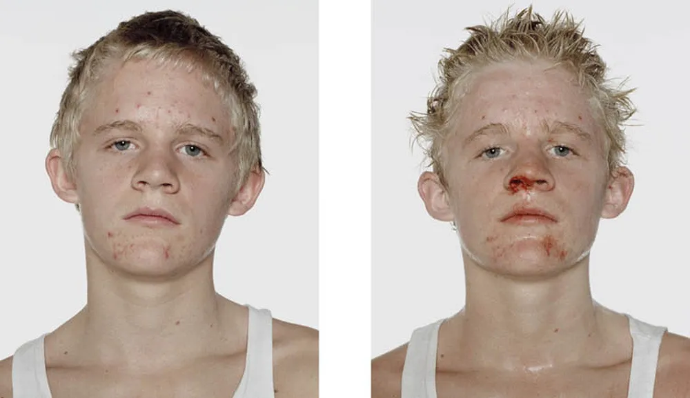 Portraits of Boxers, Before and After by Nicolai Howalt