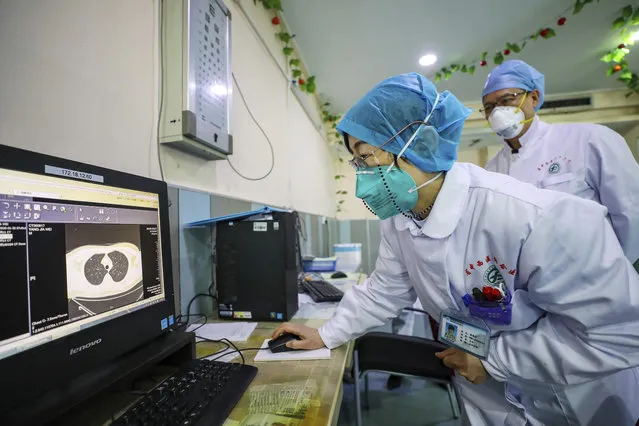 Doctors look at a CT scan of a patient at a hospital in Wuhan in central China's Hubei Province, Thursday, January 30, 2020. China counted 170 deaths from a new virus Thursday and more countries reported infections, including some spread locally, as foreign evacuees from China's worst-hit region returned home to medical observation and even isolation. (Photo by Chinatopix via AP Photo)