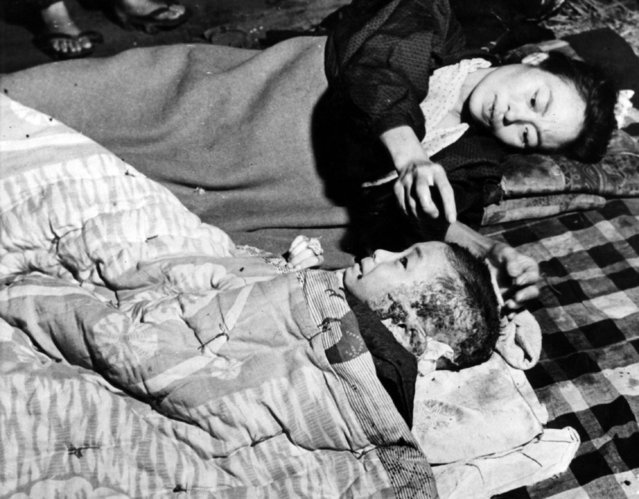 A mother tends her injured child, a victim of the atomic bomb blast at Hiroshima.  (Photo by Keystone/Getty Images)