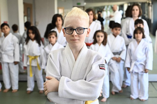 Furkan Ozorman, a child with albinism participates in a karate activity to raise awareness and end daily life and peer bullying against albinos on June 2, 2024 in Istanbul, Turkiye. Serkan Ozorman (not seen), the Chairman of the Board of Directors of the Albinism Association and his wife Ezgi Ozorman (not seen), the parents of Furkan, also support and to raise awarness to end the discriminatory attitudes towards their children and other people with albinism. (Photo by Elif Ozturk/Anadolu via Getty Images)