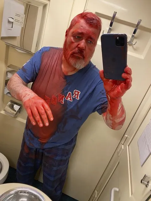 In this photo published on Novaya Gazeta Europe's Telegram channel, Nobel Peace Prize-winning newspaper editor Dmitry Muratov takes a selfie after he said he was attacked on a Russian train by an assailant who poured red paint on him, causing his eyes to burn severely, Russia, Thursday, April 7, 2022. Muratov told Novaya Gazeta Europe, a project launched by newspaper staff after the paper suspended operation last week under government pressure, that the Thursday assault happened on a train heading from Moscow to Samara. (Photo by Novaya Gazeta Europe's Telegram channel via AP Photo)