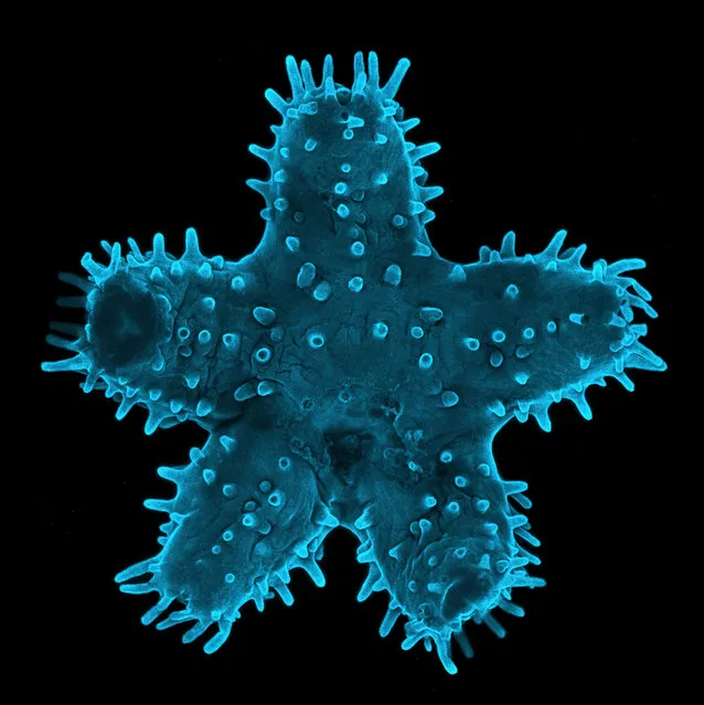 Young Starfish; Confocal, 5X. Confocal Microscopy Lab, Rochester Institute of Technology, Rochester, New York, USA. (Photo by Steven Wilbert/Nikon Small World 2014)