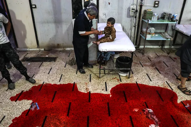 A nurse gives medical care to an injured child while another cleans blood from the floor at a hospital in rebel-held Douma, Syria, 26 October 2017. Seven people were killed after several bombs were dropped on civilian areas allegedly by forces loyal to the Syrian regime. (Photo by Mohammed Badra/EPA/EFE)