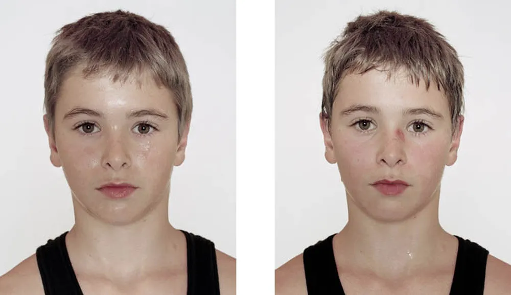 Portraits of Boxers, Before and After by Nicolai Howalt