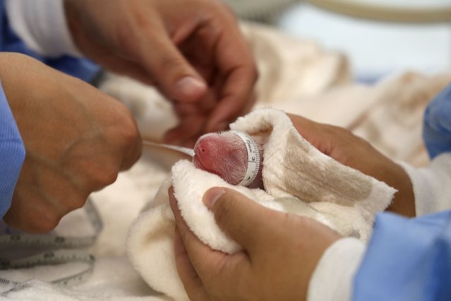 This handout photo taken on August 22, 2024 and released by the Berlin Zoological Garden on August 23, 2024 shows veterinarians tending to a new-born panda cub in an incubator after female Giant Panda Meng Meng, 11-years-old, gave birth to two cubs that day at the zoo in Berlin, Germany. Female panda Meng Meng has given birth to twins again, five years after giving birth to her first offspring, the zoo announced on August 23. The two cubs, measuring just 14 centimeters and weighing 136 and 169 grams respectively, were born just over an hour apart on August 22 and “are doing well”, the zoo said in a statement. (Photo by Handout/Berlin Zoological Garden via AFP Photo)