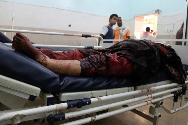 A wounded woman lays in a hospital bed, after being wounded following a reported rocket attack on a busy market in the central city of Taiz on June 3, 2016. (Photo by Ahmad Al-Basha/AFP Photo)