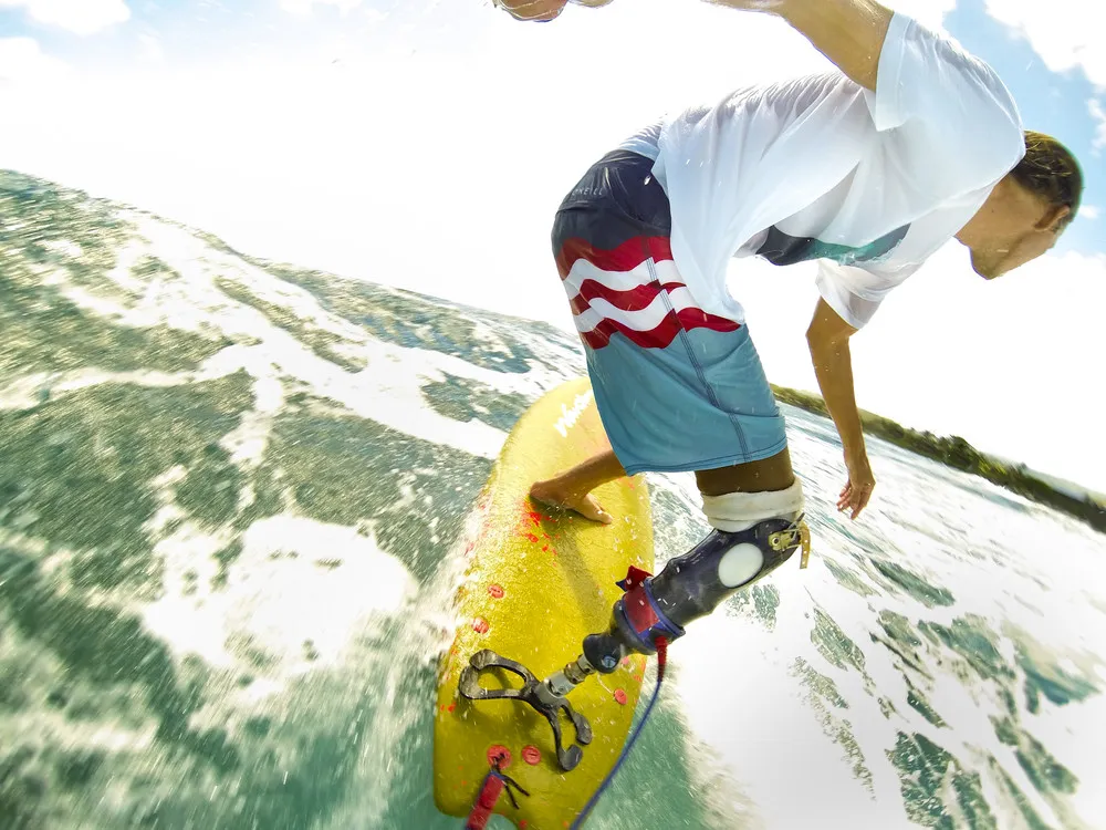 Applications of Bionics in Sports