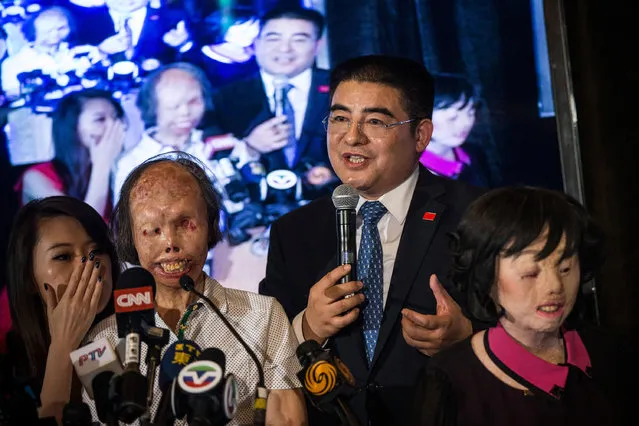 Chen Guangbiao, a Chinese recycling magnate worth approximately $400 Million, speaks with two severely deformed women, one of whom he claims to have paid for plastic surgery for, during a lunch he hosted for a group of approximately 200 homeless people, at the Boat House in Central Park, on June 25, 2014 in New York City. (Photo by Andrew Burton/Getty Images)