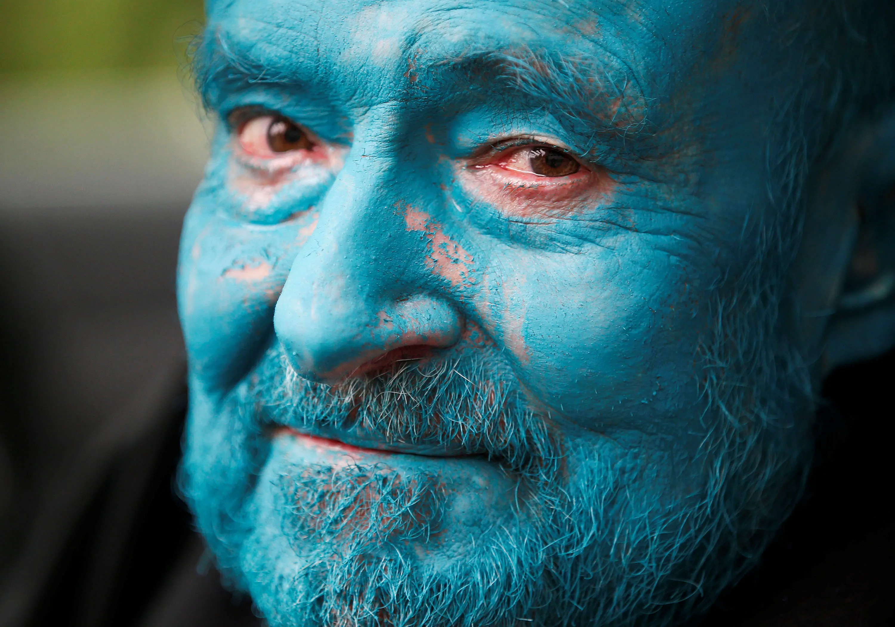 Синяя кожа у человека. Синее лицо. Голубой человек.