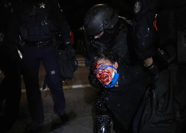 A policeman arrests a protestor injured in the face and bleeding in Portland, on September 4, 2020 during a march to denounce police brutality and racism. Portland this weekend marks 100 days since protests erupted in the western US city to denounce police brutality and racism, shining a spotlight on a deeply polarized America as it prepares for high-stakes elections. The nightly protests, sparked by the death of an African American while in police custody in Minneapolis in May, escalated sharply in the Oregon city after the administration deployed federal agents to protect federal property from damage. (Photo by Allison Dinner/AFP Photo)