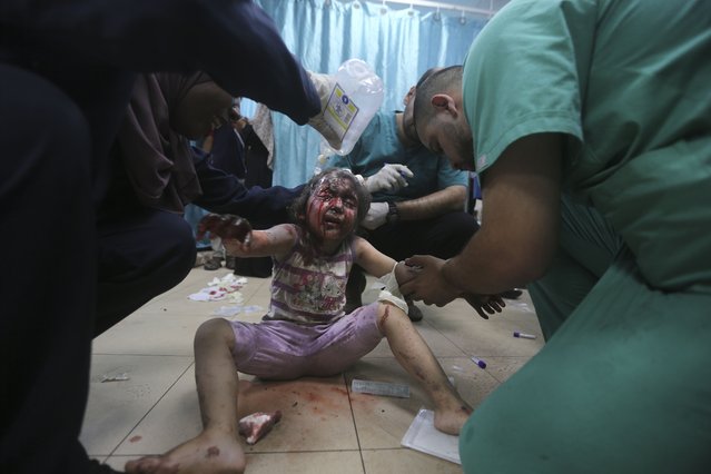 Palestinians wounded in the Israeli bombardment of the Gaza Strip arrive at al-Aqsa Hospital in Deir al-Balah, central Gaza Strip, Saturday, June 8, 2024. (Photo by Ismael Abu Dayyah/AP Photo)