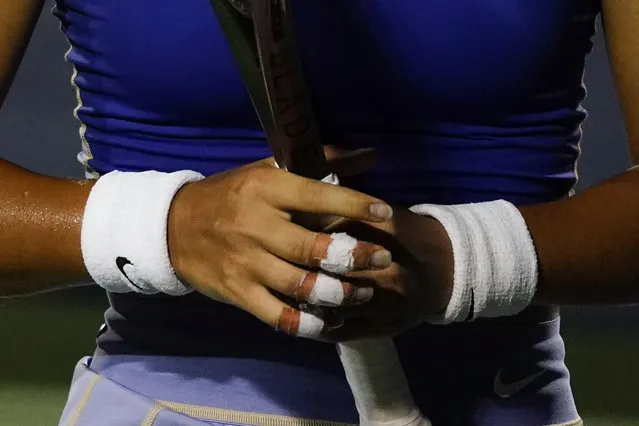 Bandages on the hands of Emma Raducanu of Great Britain during her women's singles match against Ludmilla Samsonova of Russia at the Citi Open ATP tennis tournament at the Rock Creek Park Tennis Center in Washington, DC, USA, 05 August 2022. (Photo by Will Oliver/EPA/EFE)