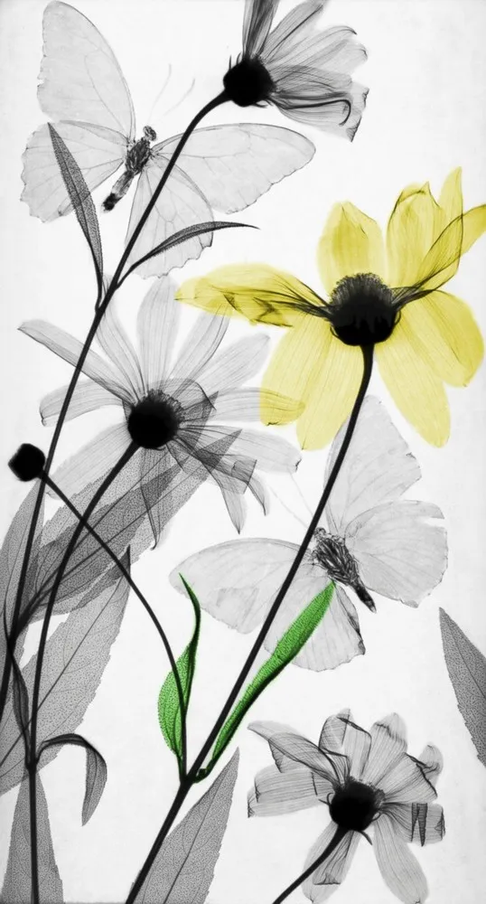 Colorized X-ray Photographs