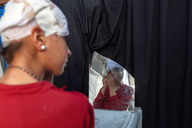 Twelve-year-old Palestinian girl Hala Abu Dahlez, who was injured in an airstrike, adjusts her earrings while looking at a mirror inside her tent in Al-Mawasi, Khan Younis, in the southern Gaza Strip, 06 July 2025. Hala sustained serious head injuries on 26 March 2025 when a metal swing set collapsed on her following an Israeli airstrike, resulting in a head injury. She underwent several surgeries, but doctors say she requires specialized treatment outside the Gaza Strip. Ongoing border closures have prevented her evacuation, risking deterioration. Hala lives with her family in a displacement camp and suffers from severe physical and psychological trauma. (Photo by Haitham Imad/EPA)