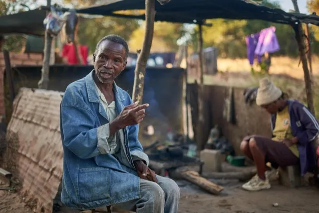 Hanganani Gideon Dube, 75, a local farmer at his homestead in Mabale Village, Hwange, Zimbabwe, on May 26, 2022. Over a year ago, he survived an elephant attack while tending to his cattle, which left him with a broken leg. Zimbabwe has no compensation policy on crop and property damages, or injuries and fatalities from animal attacks. Hwange National Park is overflowing with elephants, which now routinely wander outside the boundaries to feed, sometimes running into deadly conflicts with people living in the surrounds. Zimbabwe and its neighbours in southern Africa have seen their elephant herds thrive in recent years and are now home to about 70 percent of the continent's elephants. (Photo by Zinyange Auntony/AFP Photo)