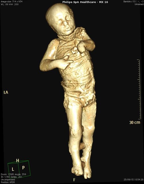 A handout image released by Pompeii's Archaeological Superintendence Press Office on 29 September 2015 shows a Cat scan (Computerized axial tomography) of the cast from one of the victims of the eruption of Vesuvius in 79 AD in Pompeii, in Naples, Italy. (Photo by Cesare Abbate/EPA)