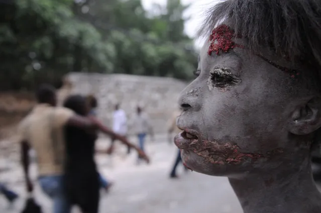 An injured person is seen after an earthquake hit Port-au-Prince, Haiti, Tuesday, January 12, 2010. A 7.0-magnitude earthquake, the largest ever recorded in the area, rocked Haiti on Tuesday. (Photo by Jorge Cruz/AP Photo)