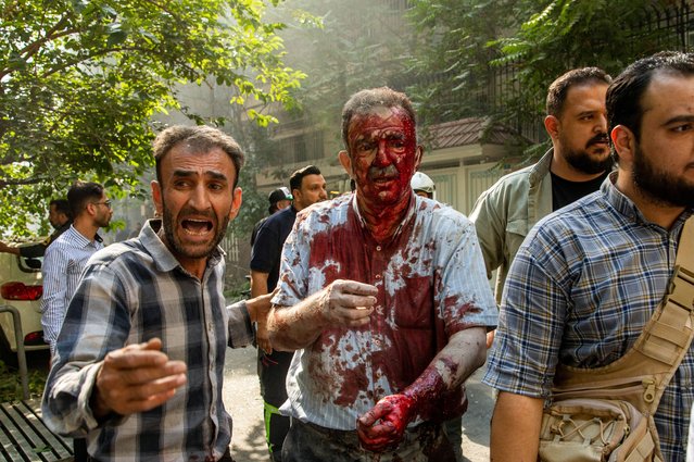 People help a wounded man following an Israel airstrike in central Tehran, Iran, 15 June 2025. Israel and Iran have been exchanging fire since Israel attacked Iran on 13 June 2025 as part of operation “Rising Lion”. (Photo by Majid Khahi/EPA/EFE)