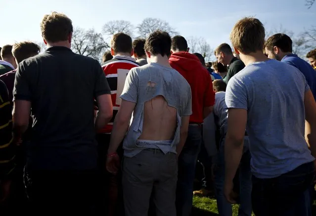 An injured player looks into the scrum during the bottle-kicking game in Hallaton, central England April 6, 2015. (Photo by Darren Staples/Reuters)