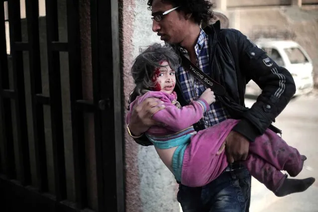 A Syrian photographer carries an injured girl following reported air strikes by regime forces on the town of al-Nashabiyah in the eastern Ghouta region, a rebel stronghold east of the capital Damascus, on December 14, 2015. (Photo by Amer Almohibany/AFP Photo)