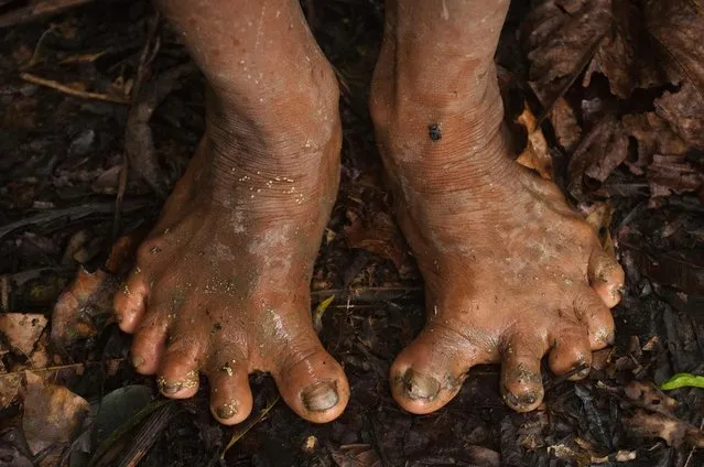 One member of the tribe appeared to have deformed feet. (Photo by Pete Oxford/Mediadrumworld.com)