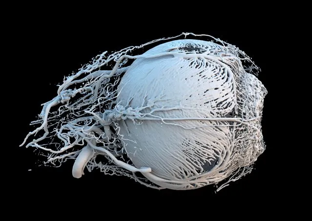 A 3D model of a healthy mini-pig eye. The dent on the right-hand side of this 3D model of a pig eye is the pupil, the opening that allows light into the eye. Blood vessels are pumped up, bringing energy and food to the muscles surrounding the iris, which controls the amount of light entering the eye. The smallest vessels seen here are just 20-30 micrometres (0.02-0.03 mm) in diameter. The other large vessels are feeder vessels for the retina, the light-sensing region at the back of the eye. (Photo by Dr Peter M. Maloca/Wellcome Images)