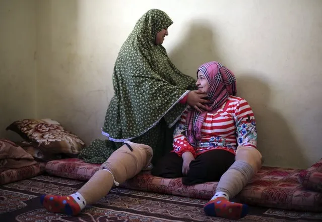 Palestinian girl Manar Al-Shinbari (R), 15, who lost her both legs by what medics said was Israeli shelling at a UN-run school where she was taking refuge during the 50-day war last summer, is helped by her sister to put on her headscarf in an apartment in Jabaliya refugee camp in the northern Gaza Strip January 13, 2015. (Photo by Mohammed Salem/Reuters)