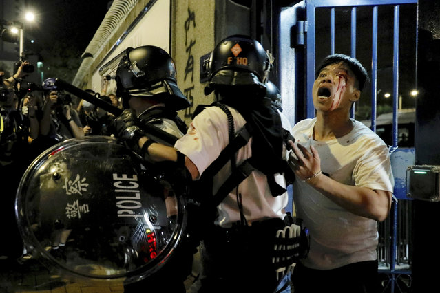 A bleeding man is taken away by policemen after attacked by protesters outside Kwai Chung police station in Hong Kong, Wednesday, July 31, 2019. Protesters clashed with police again in Hong Kong on Tuesday night after reports that some of their detained colleagues would be charged with the relatively serious charge of rioting. (Photo by Vincent Yu/AP Photo)