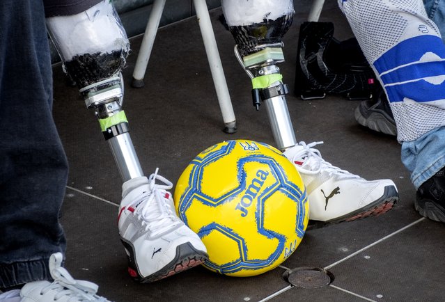 A Ukrainian war veteran with leg prosthesis watches players of Ukraine's national soccer team during a public training session in Wiesbaden, Germany, Thursday, June 13, 2024, ahead of their group E match against Romania at the Euro 2024 soccer tournament. (Photo by Michael Probst/AP Photo)