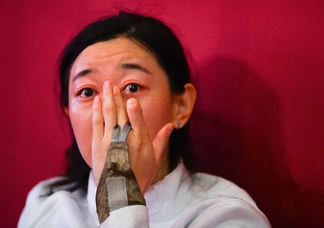 China's Sun Yiwen cries after got injured during the match against South Korea's Choi Injeong in the women’s team epee semi-final bout during the Tokyo 2020 Olympic Games at the Makuhari Messe Hall in Chiba City, Chiba Prefecture, Japan, on July 27, 2021. (Photo by Mohd Rasfan/AFP Photo)