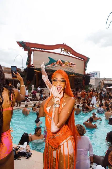 Canadian fashion model Winnie Harlow spent the weekend at The Venetian Resort Las Vegas and was seen celebrating Cay Skin at TAO Beach Dayclub in the second decade of August 2022. (Photo by Jamie Bruce)