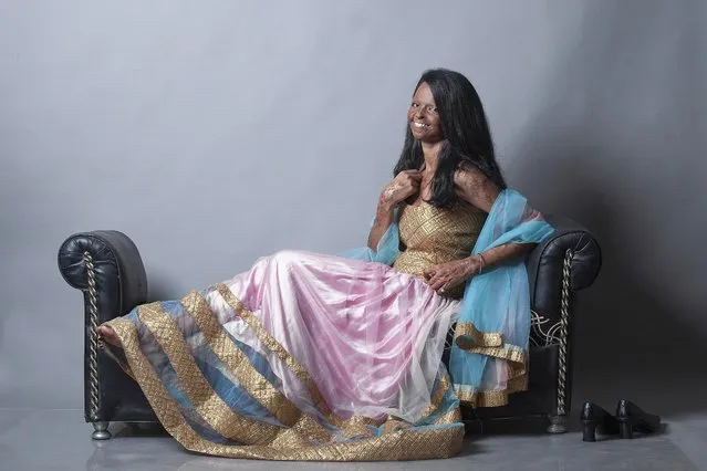 In this August 4, 2014 photo provided by Rahul Saharan, Indian acid attack victim Laxmi, 22, poses during a fashion photo shoot in New Delhi, India. Laxmi was 15 years old when she was attacked by her brother's 32-year-old friend after she refused his marriage proposal. The fashion photo shoot featuring five acid attack victims is drawing wide attention in India, where open discussions about violence against woman are drawing attention to a long-ignored public scourge. (Photo by Rahul Saharan/AP Photo)